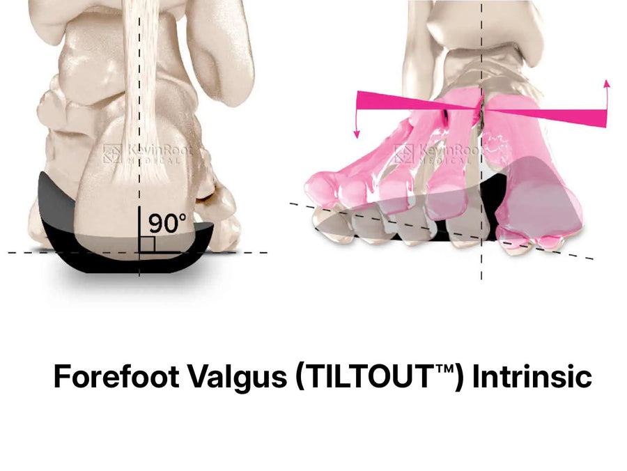 Forefoot Post