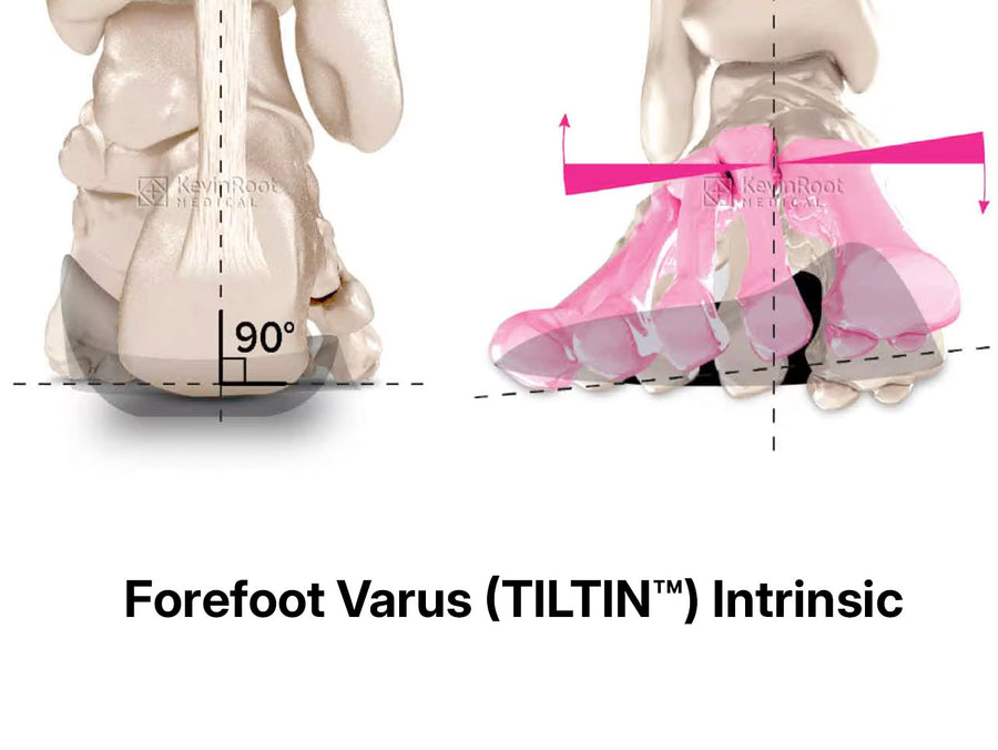 Forefoot Post illustration 1