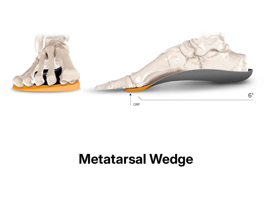 Forefoot Post illustration 4
